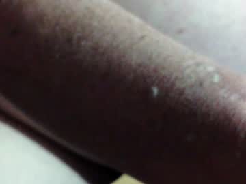 alpalo007